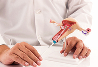 Фотографія Категорії Внутрішньоматкові контрацептиви