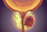 Фотографія Категорії Ліки для лікування аденоми простати