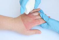 Фотографія Категорії Ліки від ран, опіків, набряків, укусів комах