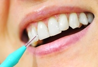 Фотографія Категорії Міжзубні (інтердентальні) щітки