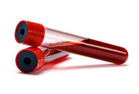 Фотографія Категорії Пробірка для забору крові