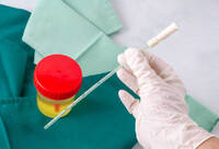 Фотографія Категорії Катетер Тіманна уретральний