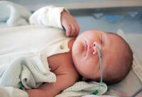 Фотографія Категорії Зонд (Катетер) назогастральний, шлунковий, дуоденальний