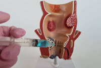 Фотографія Категорії Розчини для введення в порожнину сечового міхура